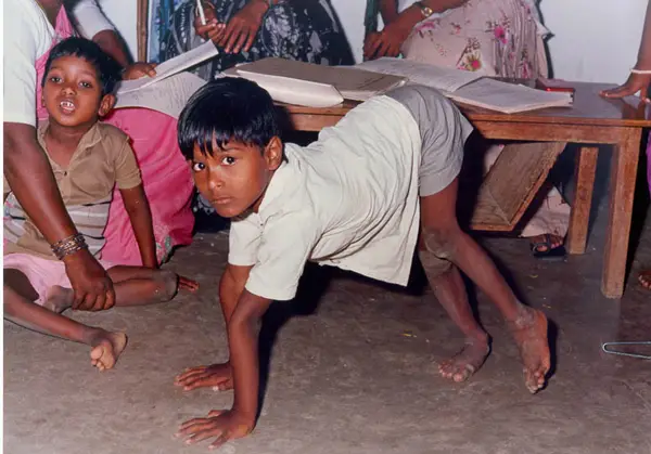 pathakwavecurecenter.in  Polio November 24, 2019 Polio-Pathak wave cure center is best place for Polio remedy – 