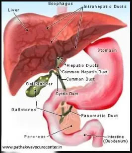 pathakwavecurecenter.in  Liver Problem November 24, 2019 Gall Stone remedy - Dr. S K Pathak is helping many people. – 